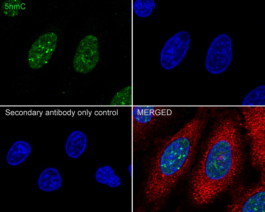 Anti-5-methylcytosine (5hmC) Antibody