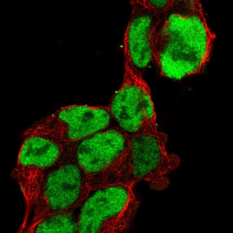 Anti-PAX6 Rabbit mAb