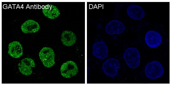 Anti-GATA4 Rabbit mAb