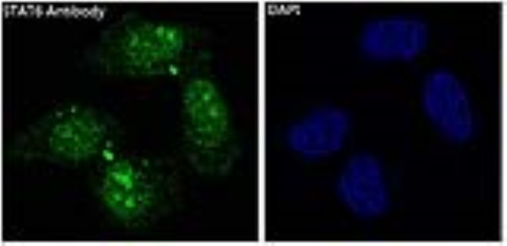 Stat6 antibody images-ICC