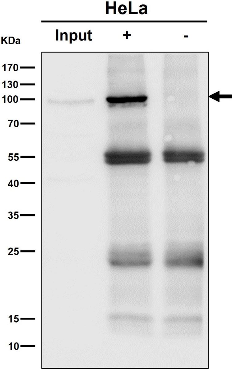 Immunoprecipitation, Stat6 Antibody