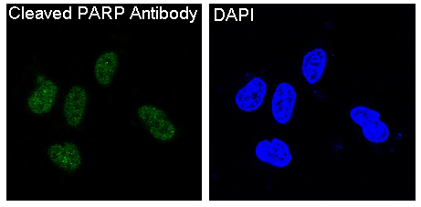 Anti-Cleaved PARP1 (Asp214) Rabbit mAb