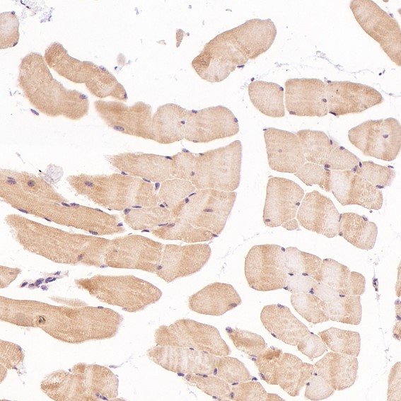 Anti-Cleaved PARP1 (Asp214) Rabbit mAb