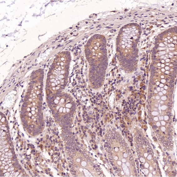 Anti-Cleaved PARP1 (Asp214) Rabbit mAb