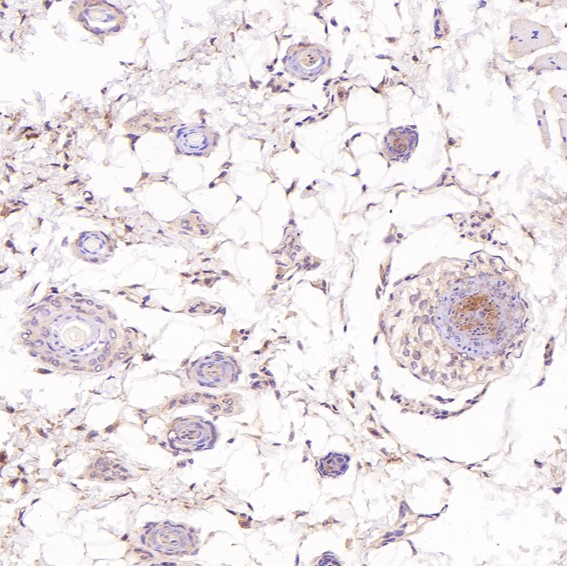 Anti-Cleaved PARP1 (Asp214) Rabbit mAb