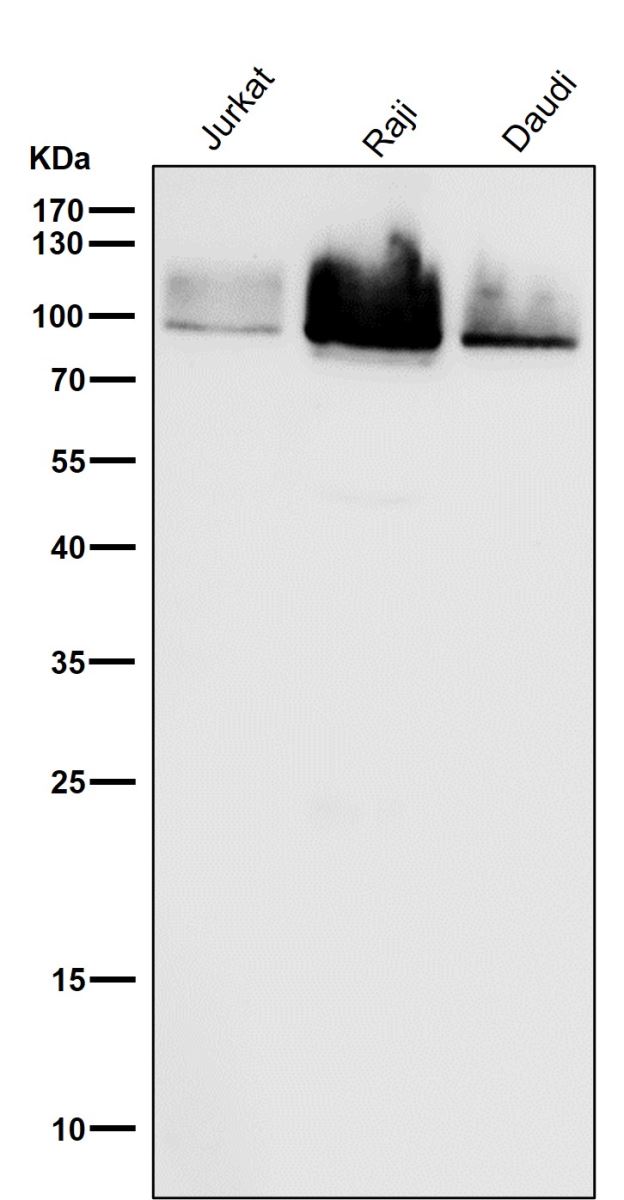 Anti-Cleaved PARP1 (Asp214) Rabbit mAb