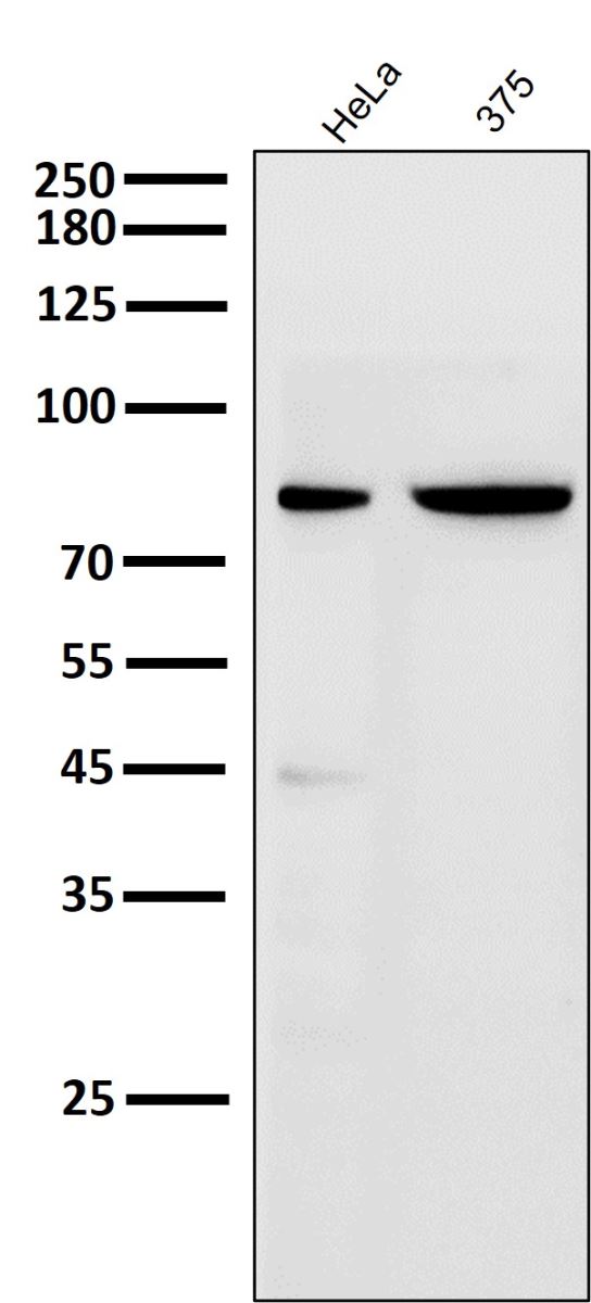 Anti-Cleaved PARP1 (Asp214) Rabbit mAb