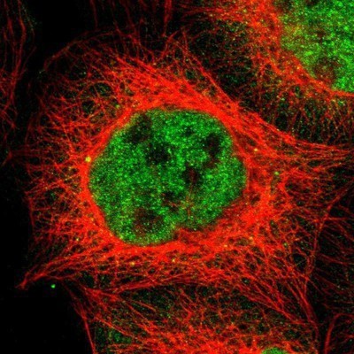 Anti-Glucocorticoid Receptor Rabbit mAb