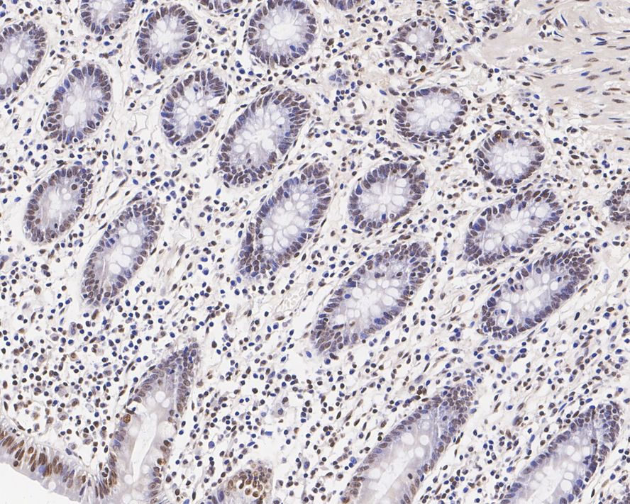 IHC was performed using anti-m5C antibody