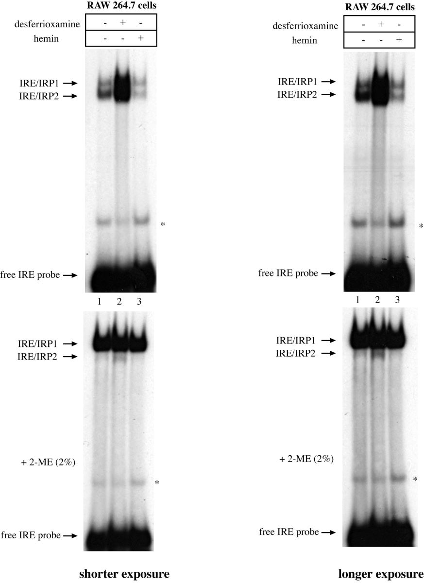 RNA-EMSA assay of the IRE/IRP example