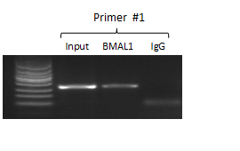 ChIP-PCR