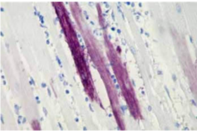 Anti-GFP tag antibody images: IHC