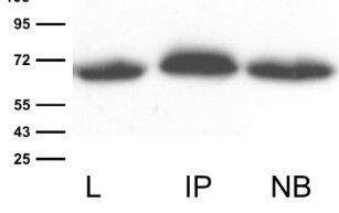 Anti-GFP tag antibody images: IP