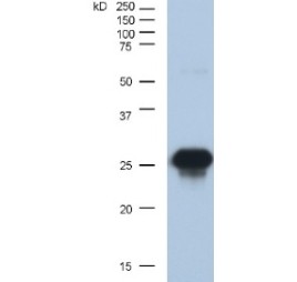 Anti-GFP tag antibody images: Western blotting