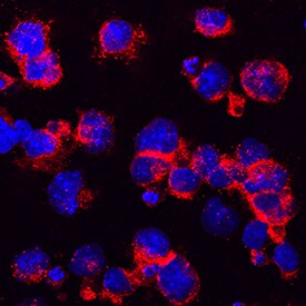 Anti-HA tag Rabbit mAb - ChIP Grade